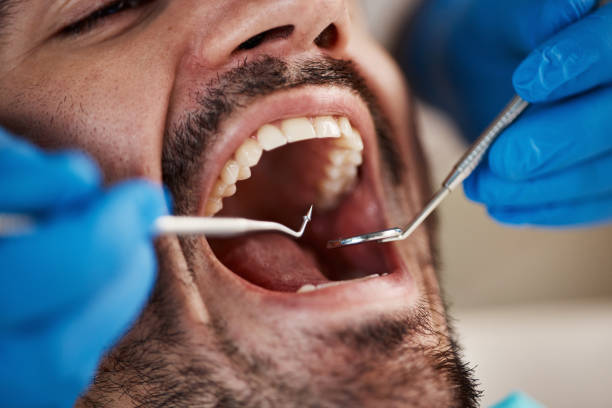 Best Root Canal Emergency Dentist  in Sioux Center, IA